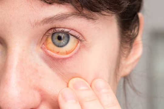 eyes predict health2 4 9