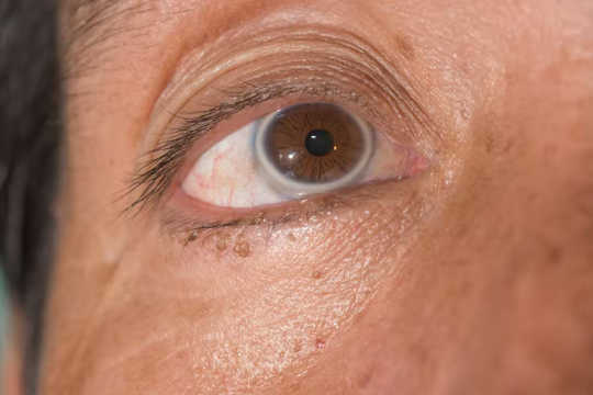 eyes predict health4 4 9