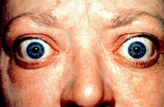 eyes predict health6 4 9